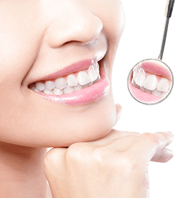 Lächelnde Frau mit Zahnarztspiegel